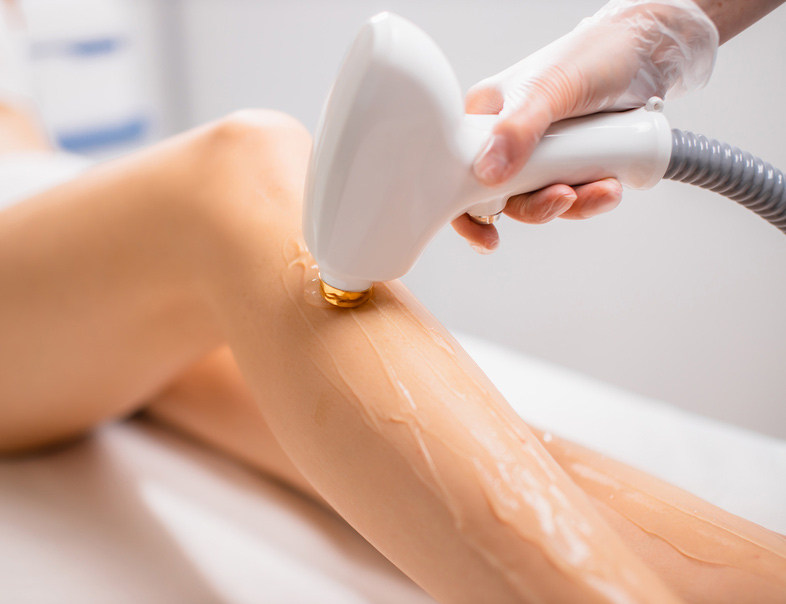 Epilation à lumière pulsée à Douai