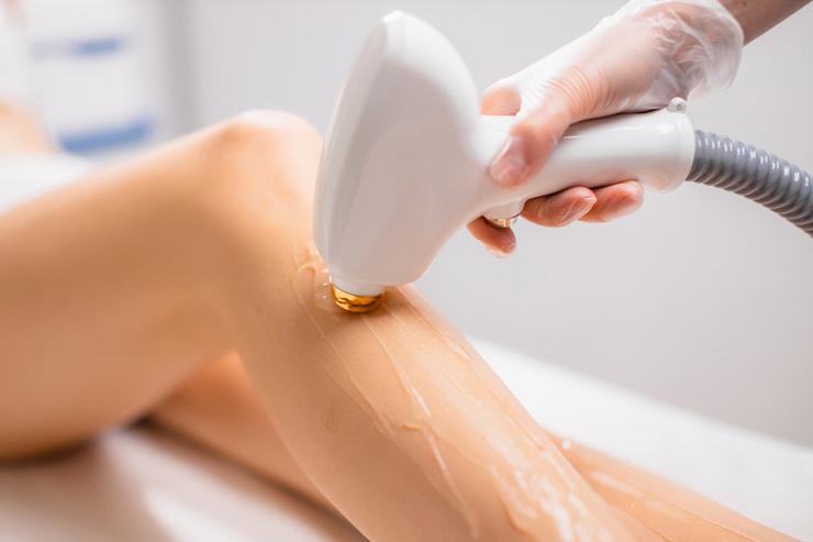 Epilation à lumière pulsée Lille